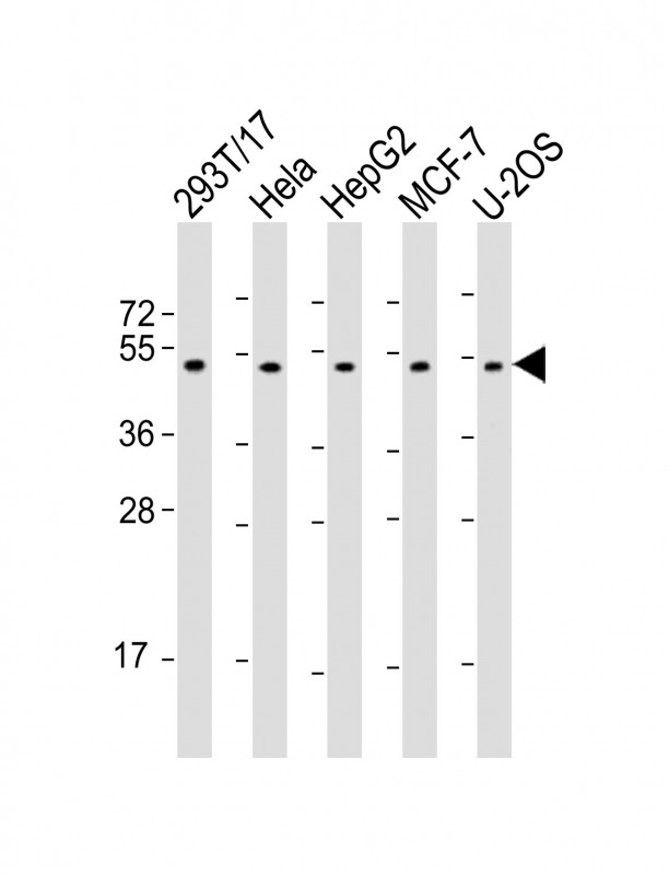 PLAGL1 (N-Term)