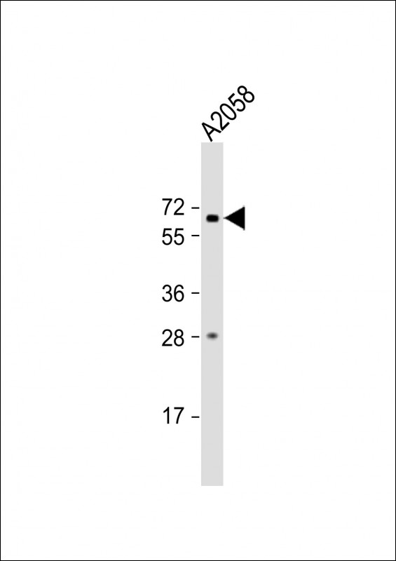 IL21R (N-Term)
