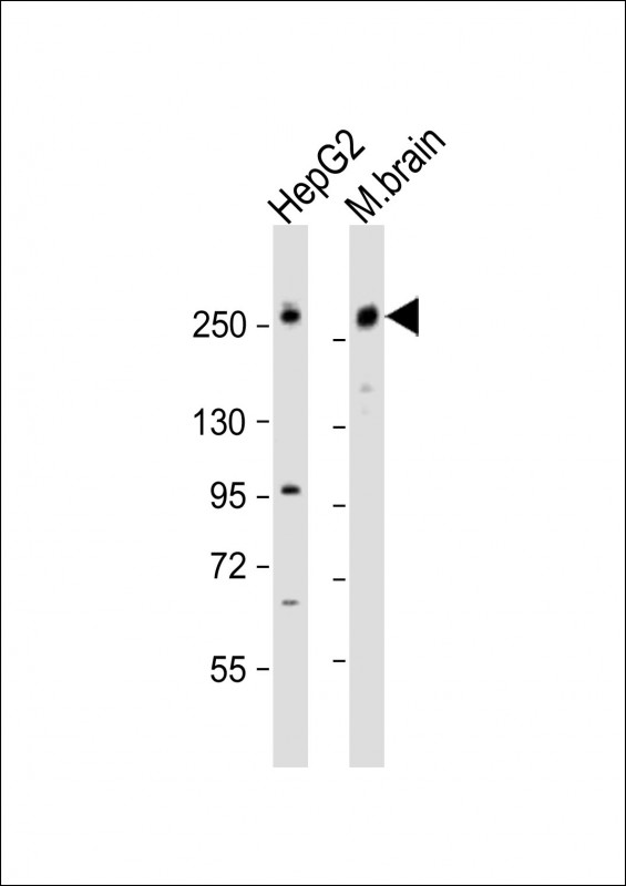 RALGAPA1 (N-Term)