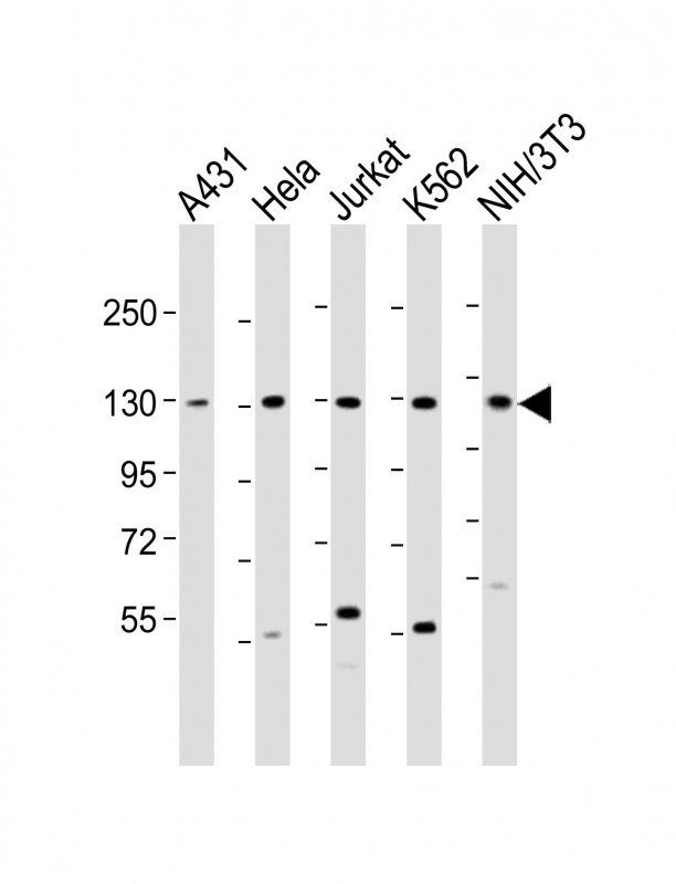 DDX42 (N-Term)
