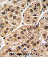 Rabbit Polyclonal Antibody to POLR1C