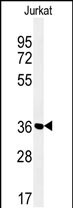 Rabbit Polyclonal Antibody to MFRN2 (N-term)