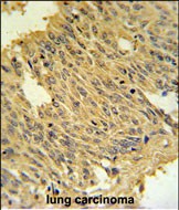 Rabbit Polyclonal Antibody to MFRN2 (N-term)
