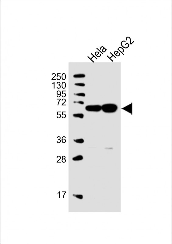 UTP6 (N-term)