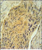 Rabbit Polyclonal Antibody to AVP