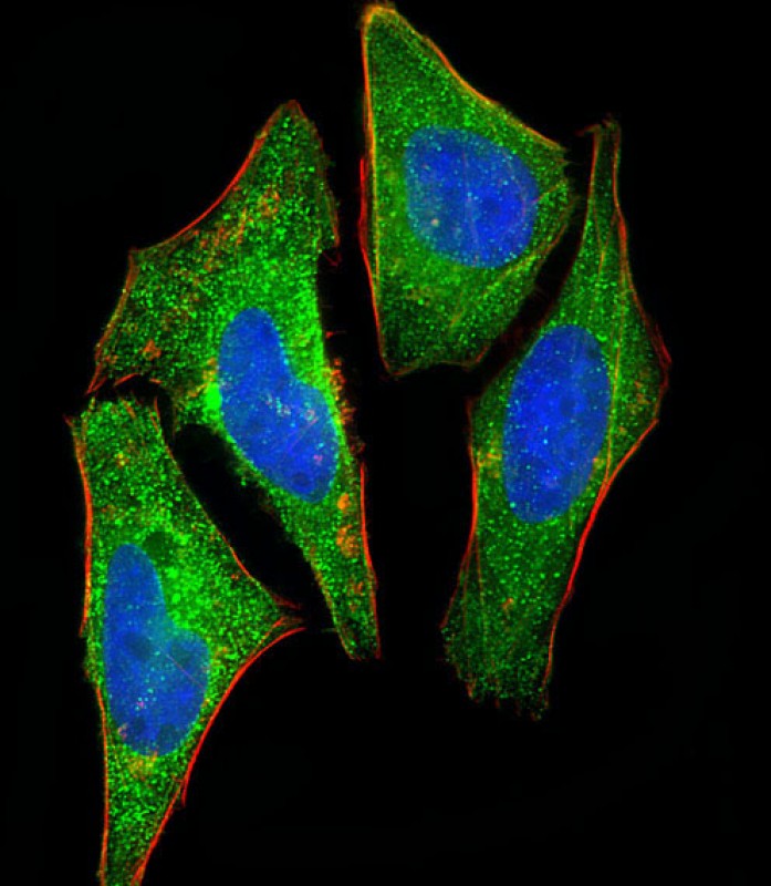 Mouse Monoclonal Antibody to S100A2