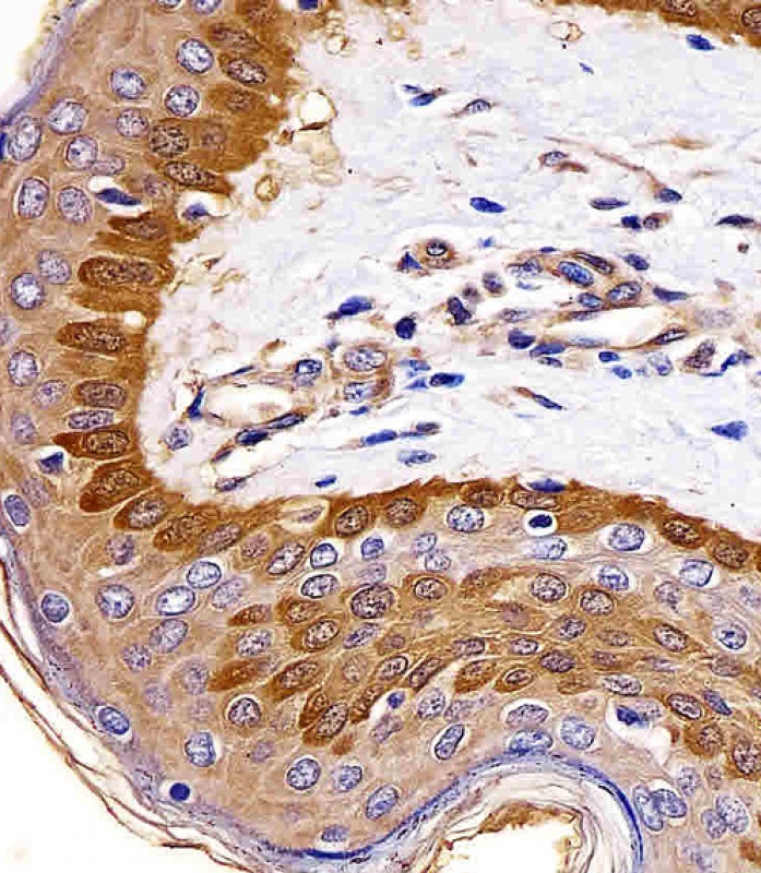 Mouse Monoclonal Antibody to S100A2
