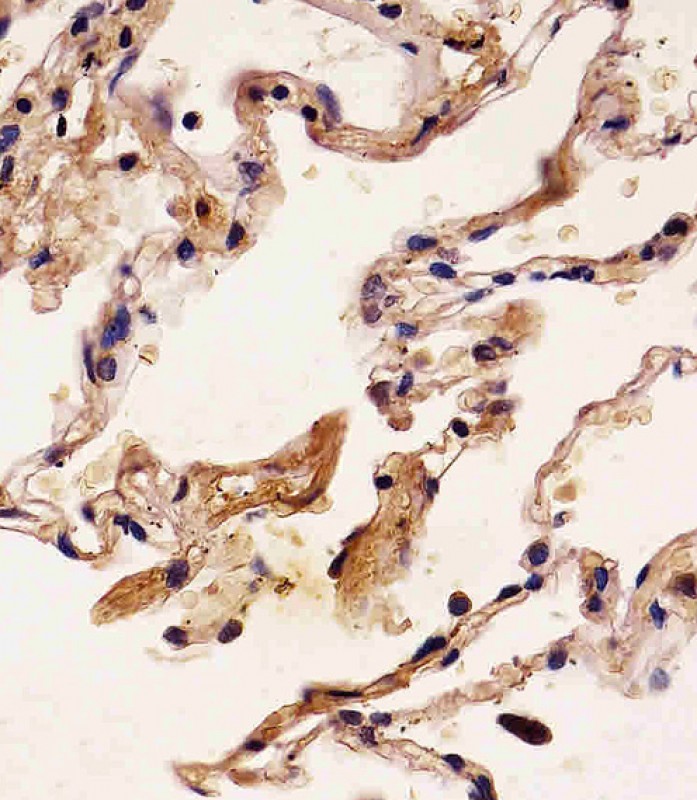 Mouse Monoclonal Antibody to S100A2