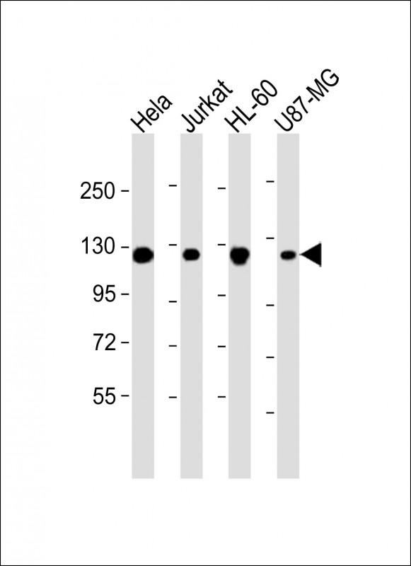 RNF20