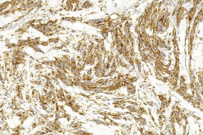 Mouse Monoclonal Antibody to MITF
