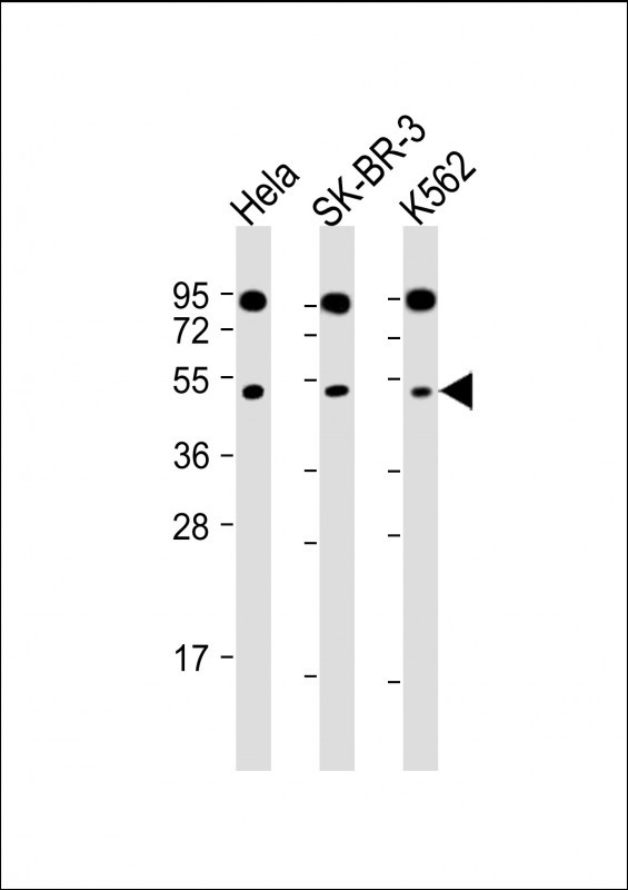 SLC16A13