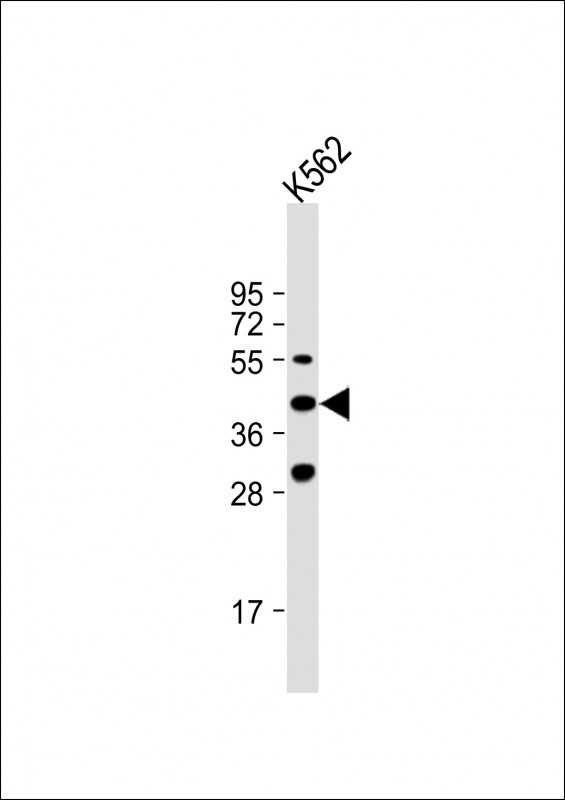 VEGF3 (N-term)