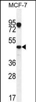 Rabbit Polyclonal Antibody to VEGF3 (N-term)