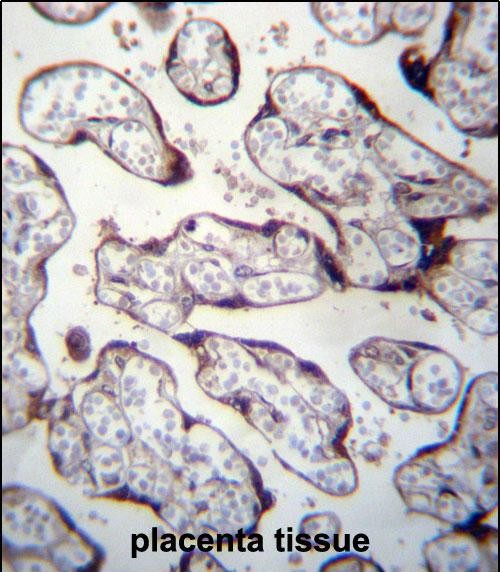 Rabbit Polyclonal Antibody to LOXL3