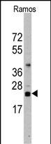 Rabbit Polyclonal Antibody to CD3Z (N-term)