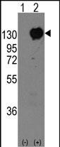 Rabbit Polyclonal Antibody to M Cadherin (CDH15)