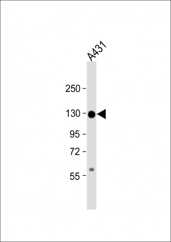 CDH3 (N-term)