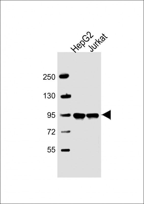 PPFIBP1