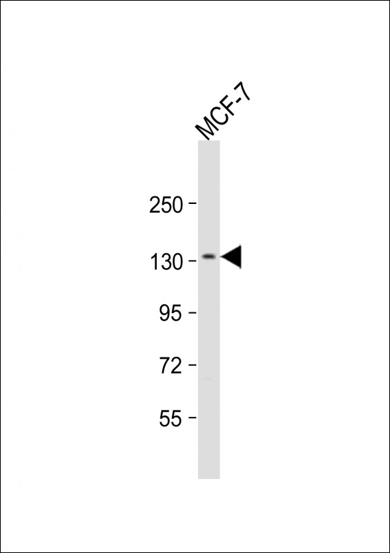 NCAM2
