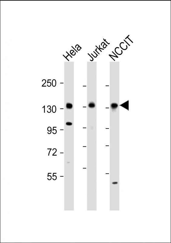 PHC1 (N-Term)