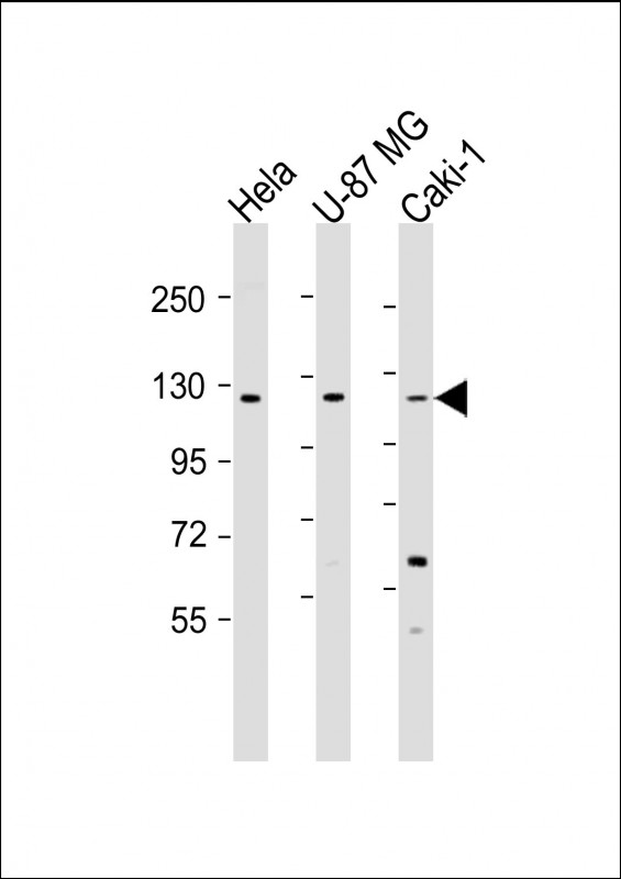 STARD8 (N-Term)