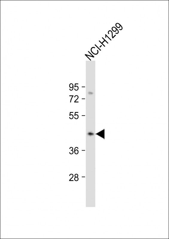 CSNK2A3 (N-Term)