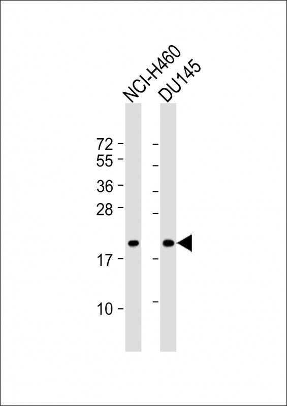 IDNK (N-Term)