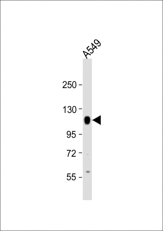 PTPN12