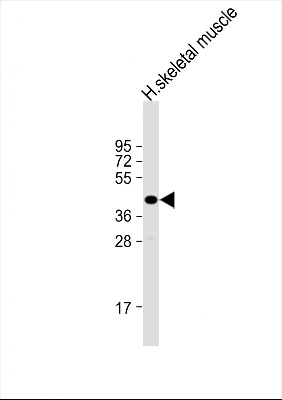 TMEM115