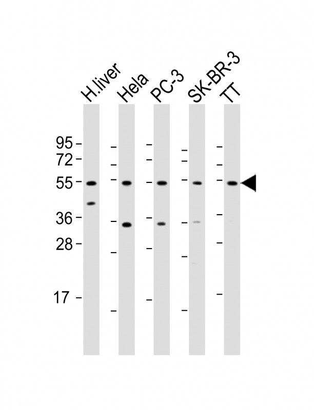 THRB (N-Term)