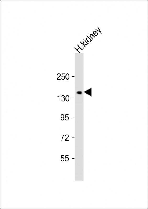 COL4A3 (N-Term)