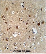 Rabbit Polyclonal Antibody to AFTPH