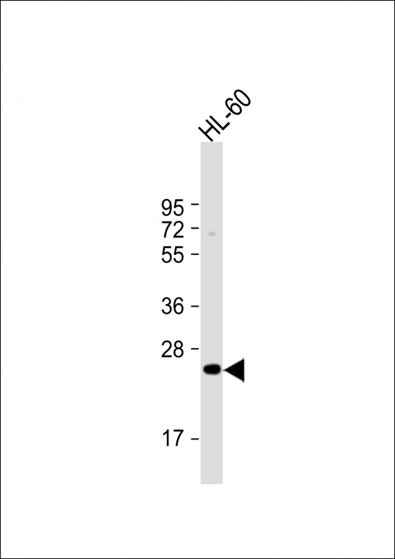MMP7