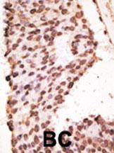Rabbit Polyclonal Antibody to MMP7