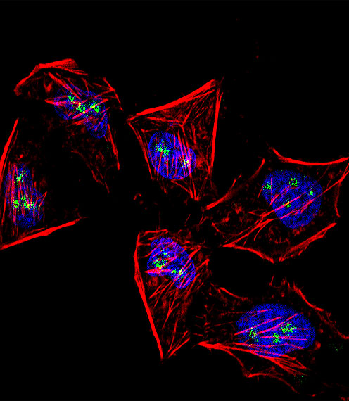 Rabbit Polyclonal Antibody to MOX1 (Meox1) (N-term)