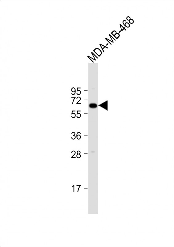 YES1 (N-term)