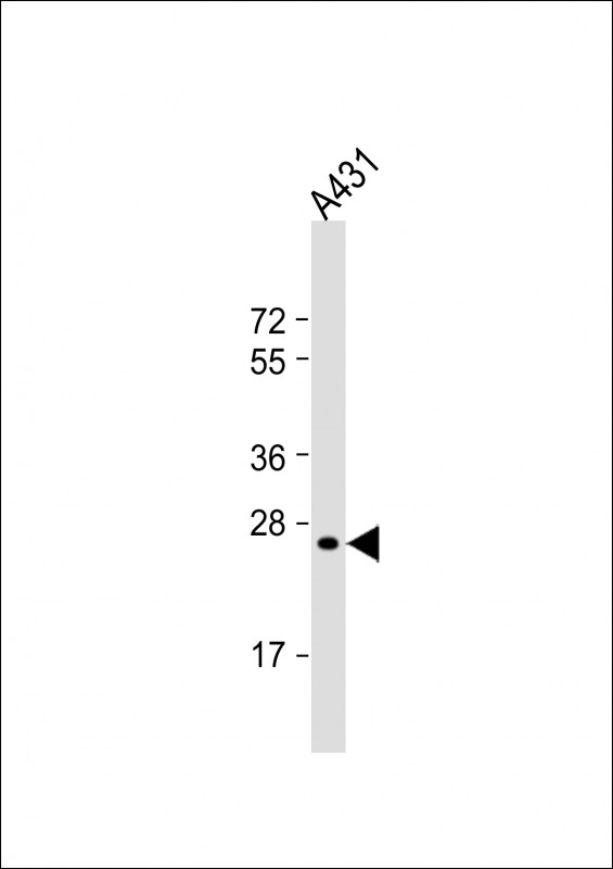 RAB5B