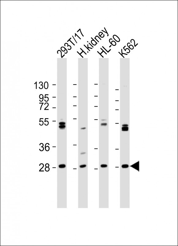ARV1  (N-term)