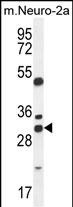 Rabbit Polyclonal Antibody to ARV1  (N-term)