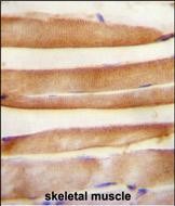 Rabbit Polyclonal Antibody to ARV1  (N-term)