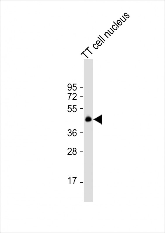 NKX2-1 (N-term)