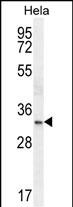 Rabbit Polyclonal Antibody to NKX2-1 (N-term)