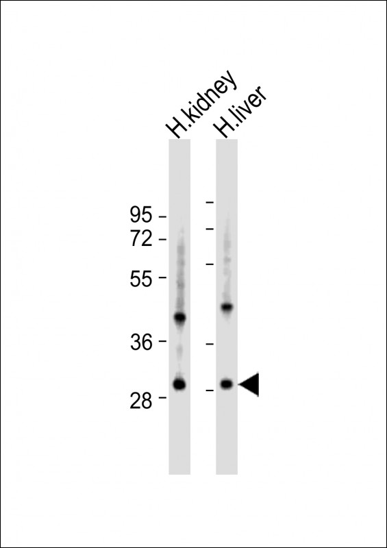 U119B  (C-term)