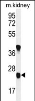 Rabbit Polyclonal Antibody to U119B  (C-term)