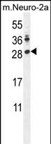 Rabbit Polyclonal Antibody to LIN28A