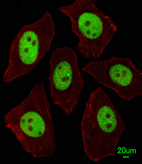 Rabbit Polyclonal Antibody to LIN28A