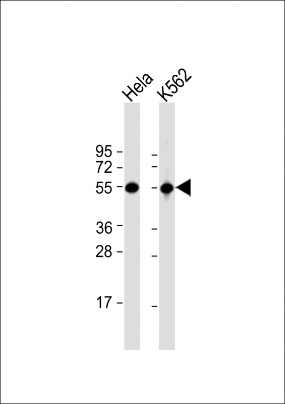 ATP6V1B1