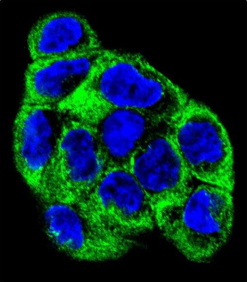 Rabbit Polyclonal Antibody to ATP6V1B1