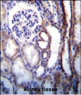 Rabbit Polyclonal Antibody to ATP6V1B1