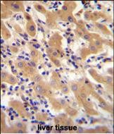 Rabbit Polyclonal Antibody to F11